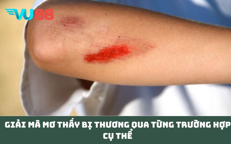 Giải mã Mơ thấy bị thương qua từng trường hợp cụ thể